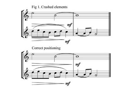 sibelius flip stem